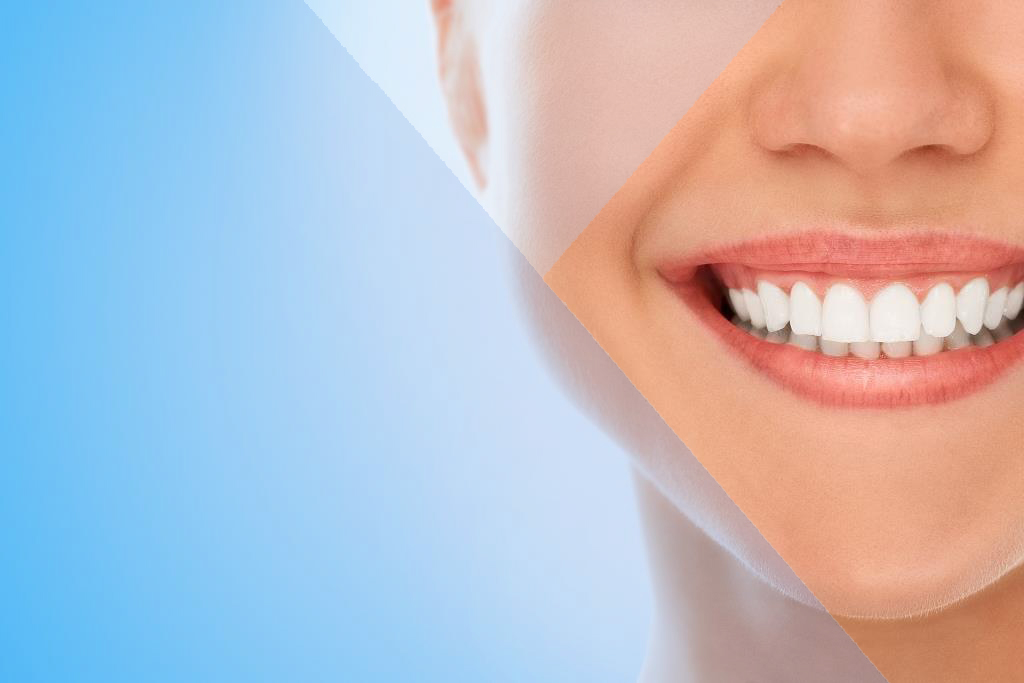 A woman is smiling while being at the dentist